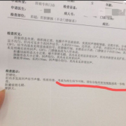 b超对胎儿辐射大吗（b超探头停留多久对胎儿有影响呢？一次多久最合适呢）