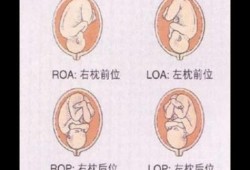 头位loa的胎儿图解（Lorael是什么意思）