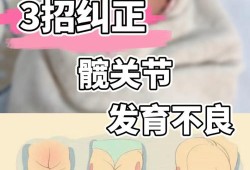 10个月宝宝大腿纹路不对称这正常不,胎儿腿直臀位什么意思