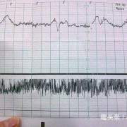 什么原因造成胎儿缺氧（胎心弱主要是因哪些因素引起的）