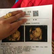 27周胎儿做四维彩超（27周胎儿做四维彩超要憋尿吗）