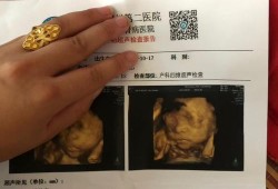 27周胎儿做四维彩超（27周胎儿做四维彩超要憋尿吗）