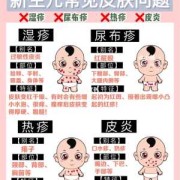 新生儿湿疹怎么办,如何预防胎儿湿疹的发生
