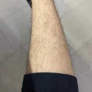 怀孕了体毛很旺盛正常吗,孕期毛发旺盛怎么办