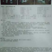 胎儿双肾回声增强是什么意思（胎儿双肾回声增强是什么意思很严重吗）