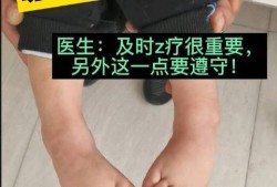 胎儿左足内翻（宝宝脚内翻怎么回事）
