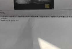 孕囊形态欠规则小孩能要吗,孕囊不规则胎儿能要吗胎芽正常