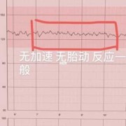 电脑胎儿监护图怎么看（电脑胎儿监护图怎么看宫缩）