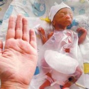 孕8个月胎儿（8个月宝宝肚子胀气怎么办）