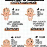 孕期湿疹产后怎么办啊（孕期湿疹产后怎么办啊）