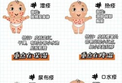 孕期湿疹产后怎么办啊（孕期湿疹产后怎么办啊）