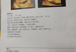 胎儿NT高（胎儿nt高怎么办）