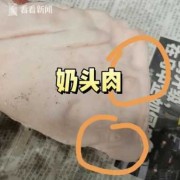 买了块猪肉，上面有个乳头能吃吗,孕期吃乳头疼怎么办