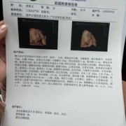 七个月胎儿有多重算是正常的呢,七个月胎儿彩超图片