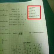 孕期心电图异常（孕期心电图异常是什么原因）