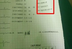 孕期心电图异常（孕期心电图异常是什么原因）