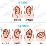 左枕后位是什么意思,胎儿枕位是什么意思图片