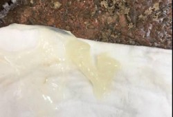 孕期胶状白带（怀孕8周大便之后流出一根粘稠状的白带啥情况）