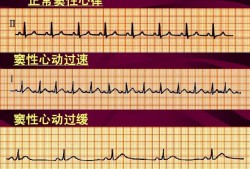 孕妇窦性心律过速110是不是属于正常的啊,孕期窦性心动过速是怎么回事