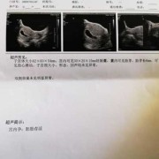 胎儿胎心不稳（胎儿胎心不稳定是什么原因）