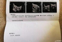 胎儿胎心不稳（胎儿胎心不稳定是什么原因）