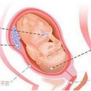 是不是必须都是入盆了以后才生啊,胎儿不入盆能顺产吗?
