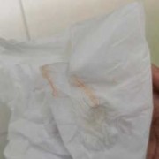孕期白带带血（孕九周，白带带血丝是怎么回事）