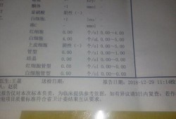 孕期尿检需要空腹吗（查尿常规需要空腹吗）