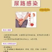 孕期尿道感染怎么办（孕期尿道感染怎么办实在太难受了）