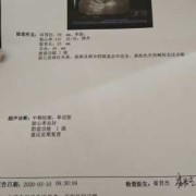 胎儿和妈妈面对面（检查说宝宝和妈妈面对面就是女孩对吗）