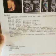 脑室增宽是什么意思。怎么治疗啊,胎儿侧脑室增宽是什么原因引起的
