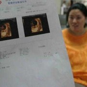 怀孕三个月胎儿彩超（三维彩超结果怎么看）