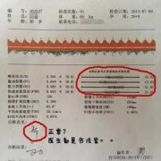 胎儿脐血流检查（孕24周脐血流隔多长时间检查一次?是不是这个要一周检查一次）