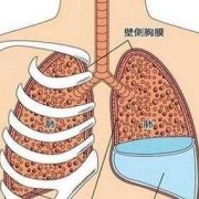 胎儿胸腔积液的原因（肺积水的原因是什么）