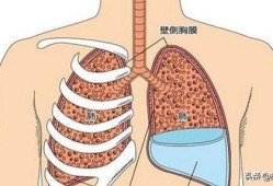 胎儿胸腔积液的原因（肺积水的原因是什么）