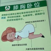 怎么让胎儿翻身（做四维怎么让胎儿翻身）
