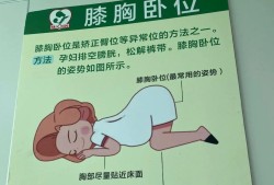 怎么让胎儿翻身（做四维怎么让胎儿翻身）