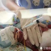 两月胎儿（两个月的宝宝才长两斤正常吗？给宝宝吃什么长肉快）