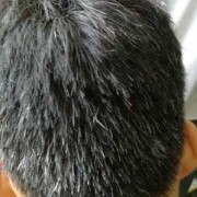 怀孕奶头变黑怎么回事？正常嘛,孕期头发变黑怎么回事