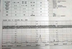 胎儿缺氧胎心会有什么反应（胎儿缺氧有什么表示）