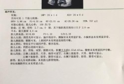 四维检查胆囊偏大，需要做羊水穿刺吗,胎儿胆囊大怎么回事儿