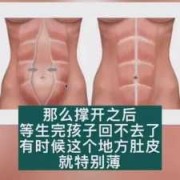 孕期腹直肌（孕期腹直肌的变化图片）