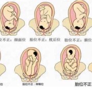 胎儿方位（胎儿方位LOA是什么意思）
