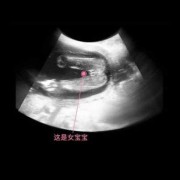 怀孕17周胎儿彩超图（孕17周胎儿在什么位置）