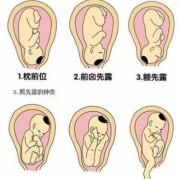 胎儿为什么会横位（胎儿为什么会横位变成臀位呢）