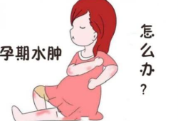 孕期腿肿怎么办（怀孕后期为什么腿肿了，孕晚期腿肿怎么办）