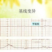 胎儿心动过缓是指（胎儿心动过缓是指胎心基线）