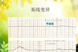 胎儿心动过缓是指（胎儿心动过缓是指胎心基线）