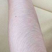 怀孕后身体毛发增多,怀孕期间头发变多了怎么回事