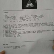 胎儿补心脏（宝宝心脏室缺怎么办）